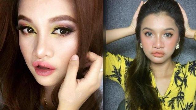 Curhat seorang sosialita tentang kondisi bibir sumbingnya.
