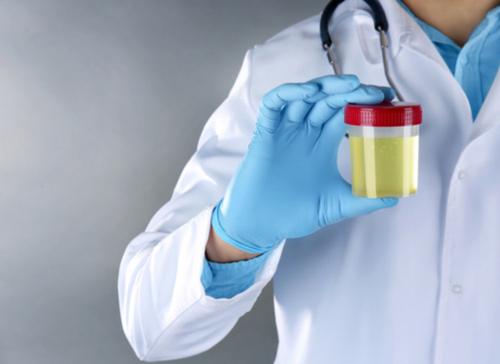 Ini Manfaat yang Diberikan Terapi Urine Gabi Kecantikan